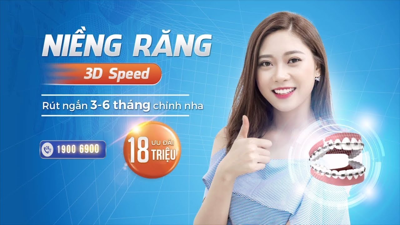 niềng răng 3d speed