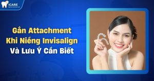 gan-attachment-khi-nieng-invisalign