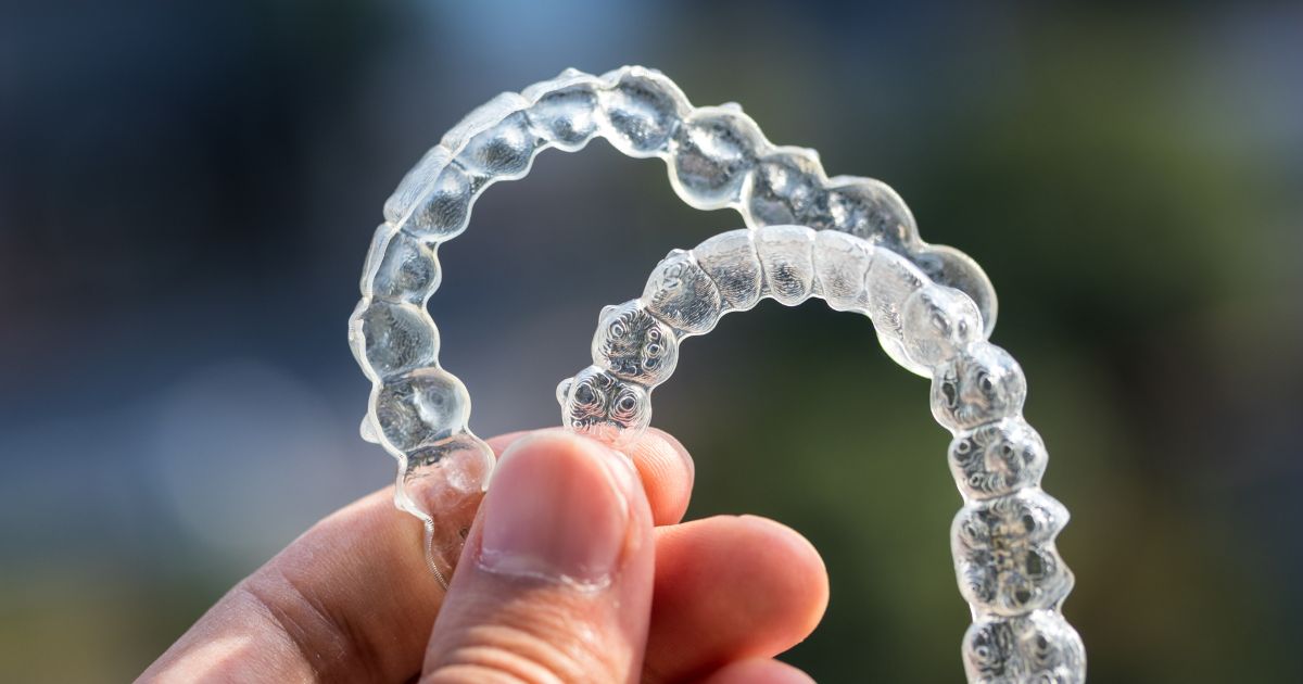 nieng-rang-invisalign-co-can-deo-ham-duy-tri-khong