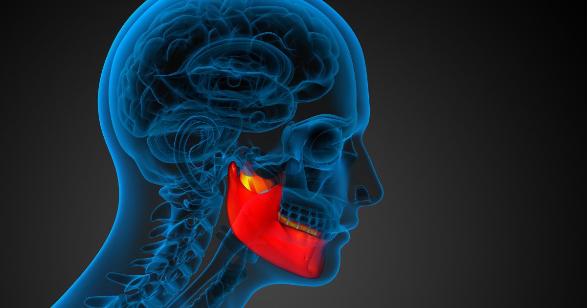 trong-rang-implant-cho-nguoi-bi-viem-nha-chu
